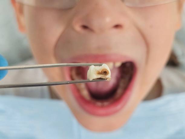 Best Emergency Pediatric Dental Care in Park City, KS