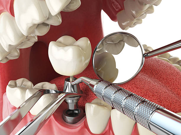 Best Dental Abscess Treatment in Park City, KS